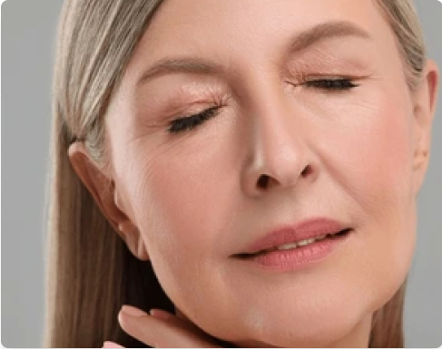 After Facial Rejuvenation